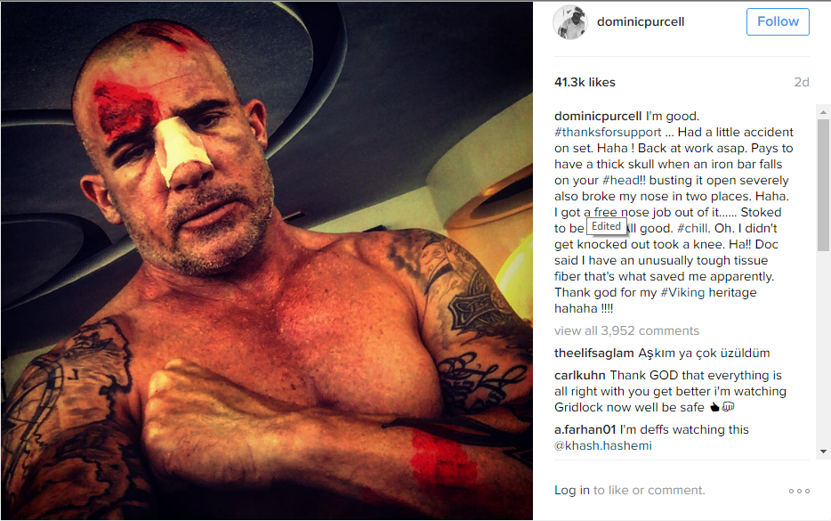 dominic purcell injury