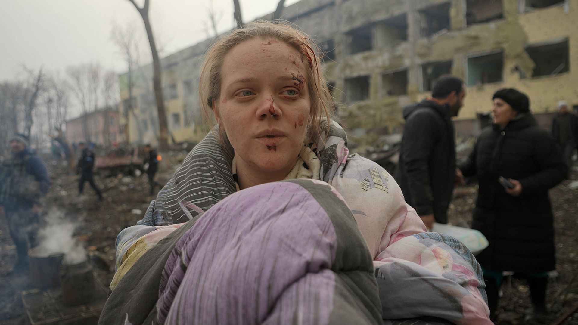 تصویر زنی مجروح در جنگ روسیه و اوکراین در مستند 20 روز در ماریوپول